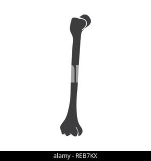 broken,fibula,shin,tibia,fracture,leg,pain,femur,surgery,bone,skeleton ...