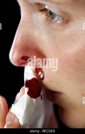 Nose of a young woman bleeding Stock Photo