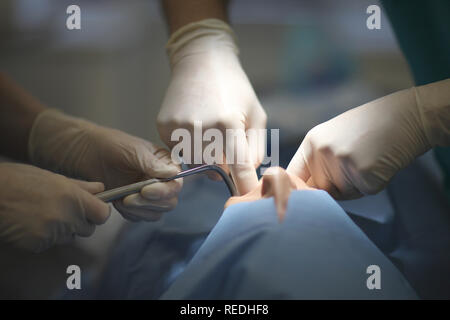 The hands of the dentist and his assistant with the tool during medical manipulations Stock Photo