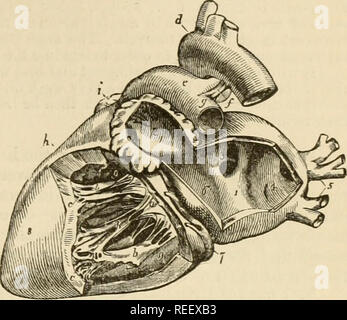 Infundibulum Heart