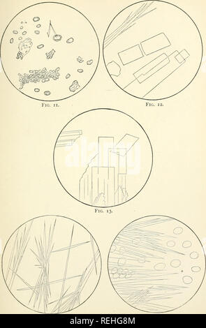 . Collected essays and articles on physiology and medicine. Medicine; Physiology. PLATE III. Fig. 14. Fig. 15.. Please note that these images are extracted from scanned page images that may have been digitally enhanced for readability - coloration and appearance of these illustrations may not perfectly resemble the original work.. Flint, Austin. New York : Appleton Stock Photo