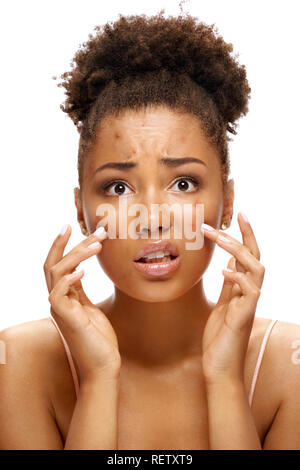 Young girl in shock of her acne. Photo of african american girl with problem skin on white background. Skin care concept Stock Photo