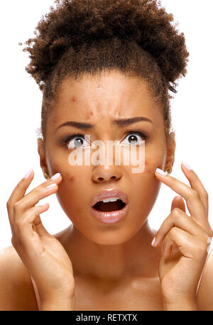 Ugly teen girl in shock of her acne. Photo of african american girl with problem skin on white background. Skin care concept Stock Photo