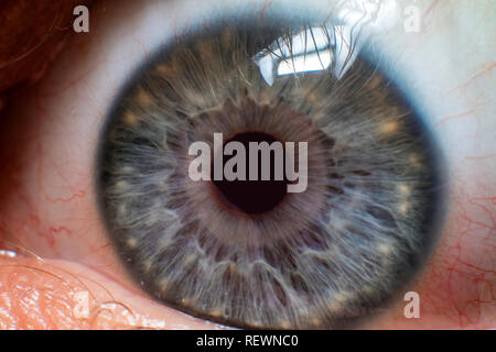 Grey eye pupil close up picture captured with flashlight Stock Photo