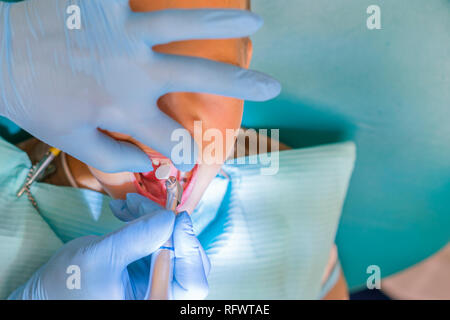 A little boy at a dentist's reception in a dental clinic. Children's dentistry, Pediatric Dentistry. A female stomatologist is treating teeth of a sch Stock Photo