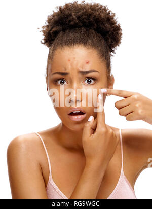 Scowling girl in shock of her acne. Photo of african american girl with problem skin on white background. Skin care concept Stock Photo