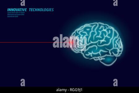 Laser surgeon brain treatment low poly 3D render. Drug nootropic human ability smart mental health. Medicine cognitive rehabilitation in Alzheimer Stock Vector