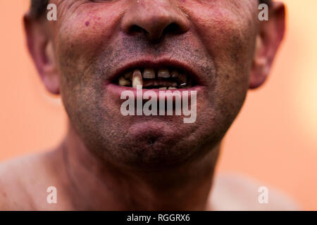 Portrait of a poor ugly old man smiling with greasy hair and denture