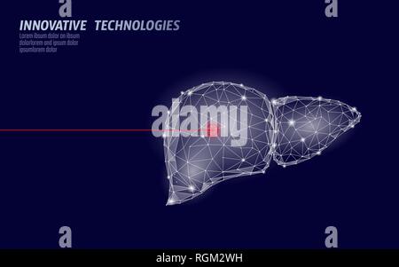 Human liver laser surgery operation low poly. Medicine disease drug treatment painful area. Red triangles polygonal 3D render shape. Pharmacy Stock Vector