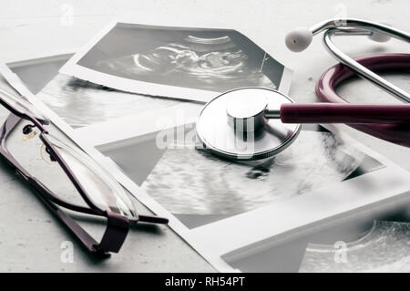 Phonendoscope vs stethoscope and glasses lie on ultrasound images of the embryo at 4 and 20 weeks of gestation. IVF in vitro fertilization concept. Ob Stock Photo