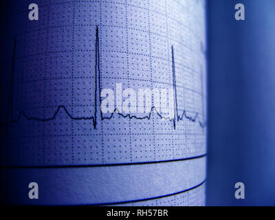 Sinus Heart Rhythm On Electrocardiogram Record Paper Showing Normal P Wave, PR and QT Interval and QRS Complex, EKG paper Stock Photo