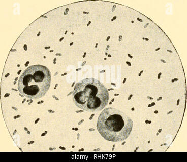 . The biology of pneumococcus; the bacteriological, biochemical, and immunological characters and activities of Diplococcus pneumoniae. Streptococcus pneumoniae; Streptococcus pneumoniae; Immunity; Immunity; Streptococcus pneumoniae. Figure 1. After Neufeld and Schnitzer1' Figure 2 THE QUELLUNG PHENOMENON Figure 1. Agglutination and Quellung of pneumococci by immune serum in vitro. Figure 2. Pneumococci from the peritoneal cavity of a mouse mixed with concentrated heterologous immune serum (control).. Please note that these images are extracted from scanned page images that may have been digit Stock Photo