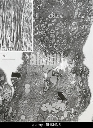 . The Biological bulletin. Biology; Zoology; Biology; Marine Biology. 40 L R. PAGE. Figure 18. Transmission electron micrograph (TEM) showing different myolilament arrangements in myocytes of the left pedal muscle (LP) and the larval retractor muscle (LRM). Scale, I ^m. Figure 19. TEM of a frontal section through a 12-day larva, showing the ipsilateral and contralateral distal branches (arrows) of the left pedal muscle. Unlike the LRM. the left pedal muscle does not show obvious striations. BM = buccal mass. Scale, 10 pm. left pedal muscle bifurcates into two distal branches (Fig. 19). One bra Stock Photo