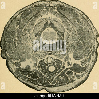 . Bensley's Practical anatomy of the rabbit : an elementary laboratory text-book in mammalian anatomy. Rabbits -- Anatomy. VI A TRANSVERSE SECTION OF THE ANTERIOR CERVICAL REGION 151. Please note that these images are extracted from scanned page images that may have been digitally enhanced for readability - coloration and appearance of these illustrations may not perfectly resemble the original work.. Bensley, B. A. (Benjamin Arthur), 1875-1934; Craigie, E. Horne (Edward Horne), 1894-. Philadephia : Blakiston Stock Photo