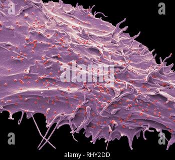 SIV infected cell, SEM