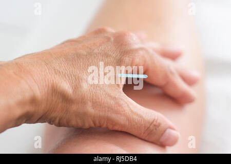 Akupunktur Nadel steckt in der Hand einer Frau Stock Photo