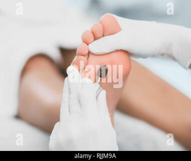 Chiropodist removes hardened skin on the foot, using hardware. Stock Photo