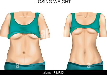 Set body of a woman before and after losing weight Stock Vector