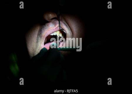 Details with the hands of a woman dentist, with surgical gloves, working with specific tools inside the mouth of a patient Stock Photo