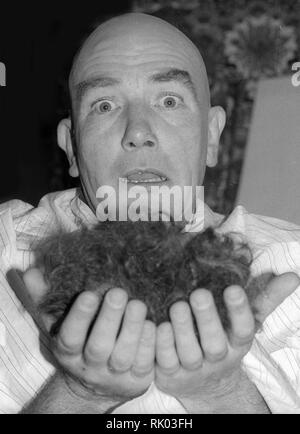 ***FILE PHOTO*** Albert Finney Has Passed Away at 82 Albert FInney 1981 Photo by Adam Scull/PHOTOlink/MediaPunch Stock Photo