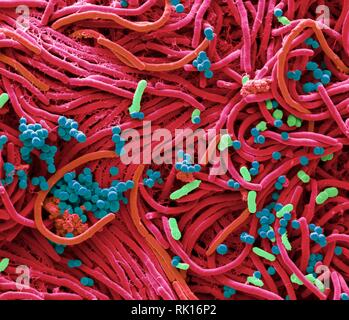 Bacteria found on mobile phone, SEM Stock Photo