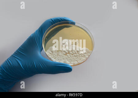 gloved hand holding mould fungus test kit Stock Photo