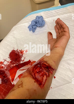 Man with an injured hand after accident at work in the carpentry workshop. Stock Photo