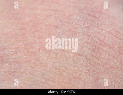 Macro Photography of Human Skin Texture for Background Stock Photo - Alamy