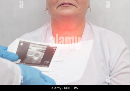 Patient at a doctor with a thyroid disease of the nodular goiter, close-up, medical, pain Stock Photo