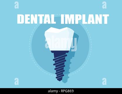 Symbol of tooth restoration. Vector of a dental implant Stock Vector