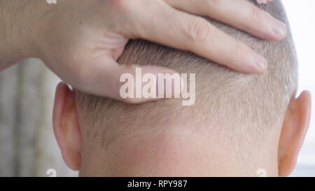 Man touching and stroking head nape while thinking close up. Headache concept Stock Photo