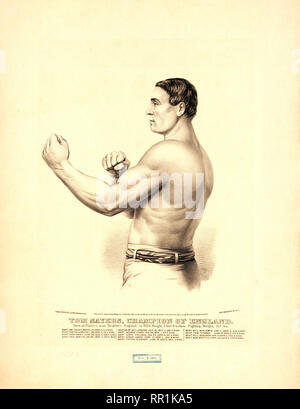 Tom Sayers, champion of England born at Pimlico, near Brighton, England, in 1826, height 5 feet 8 inches, fighting weight, 150 lbs. Stock Photo