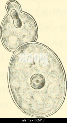 File:Aparatología fija ortodóncica.JPG - Wikimedia Commons