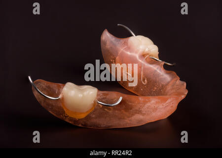 removable partial denture on a dark background Stock Photo