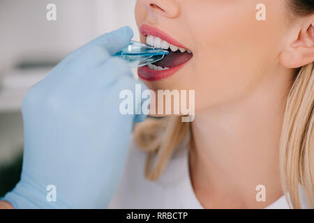 cropped view of orthodontist in latex glove putting trainer dental braces in mouth of woman during appointment in clinic Stock Photo