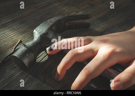 Injured hand with blackened and bruised thumbnail from bashing it resting over a hammer in a close up view in a conceptual image of DIY injuries Stock Photo