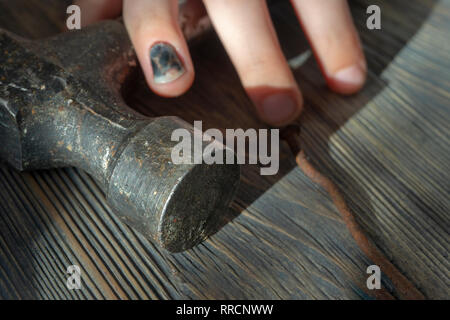 Injured hand with blackened and bruised thumbnail from bashing it resting over a hammer in a close up view in a conceptual image of DIY injuries Stock Photo