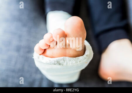 Broken leg in a cast during treatment Stock Photo