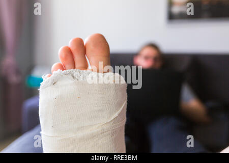 Man at home with broken leg - close up Stock Photo