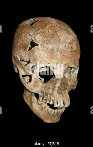 Elongated Human Skull - Costa Rica Stock Photo