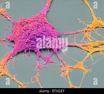 Neurone. Scanning electron micrograph (SEM) of a PC12 neurone in culture.The PC12 cell line, developed from a pheochromocytoma tumor of the rat adrena