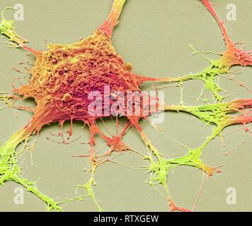 Neurone. Scanning electron micrograph (SEM) of a PC12 neurone in culture.The PC12 cell line, developed from a pheochromocytoma tumor of the rat adrena