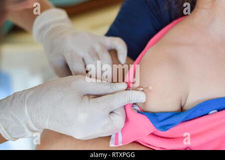 Nurse doctor giving injection vaccine with syringe in arms of the child, with the parents holding the child, do not wriggle while injecting of Stock Photo