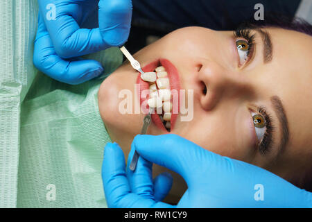 Teeth whitening at dentist. Young girl shows her teeth. White teeth. Dentist picks up shade of enamel. Close-up. Stock Photo
