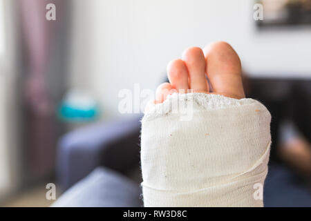 Man at home with broken leg - close up Stock Photo