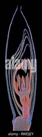 Iris Germanica inflorescence LS.,darkfield photomicrograph Stock Photo