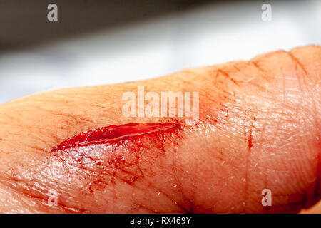 Slashed Bleeding One photo of a series of photos taken of a fresh bleeding cut ...