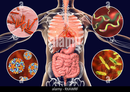 Bacteria that cause human infections, illustration Stock Photo