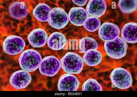 Burkitt's lymphoma cells, illustration Stock Photo