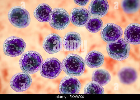 Burkitt's lymphoma cells, illustration Stock Photo - Alamy